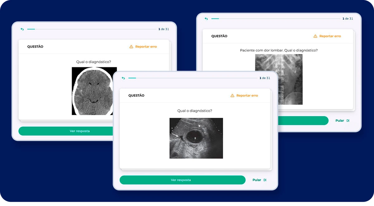 Flashcards radiológicos
