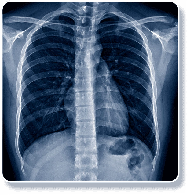 Aprovações no Brasil